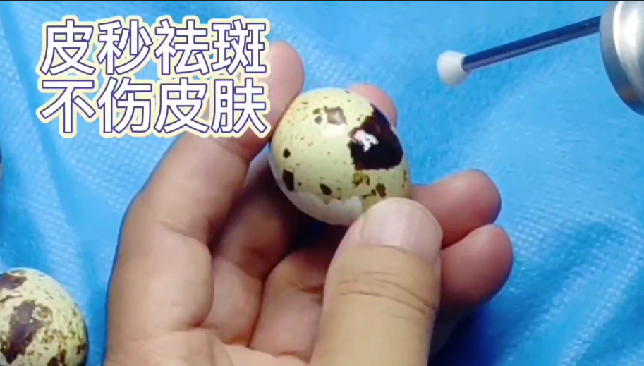 洛阳新里程医院皮肤科皮秒祛斑演示