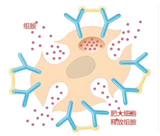 荨麻疹：为什么反反复复？