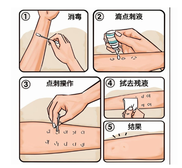 儿童过敏全指南：症状、检测与脱敏治疗详解