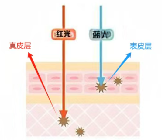 痘痘的救星——皮肤科的红蓝光