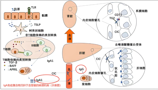 过敏性紫癜是真的过敏了吗？