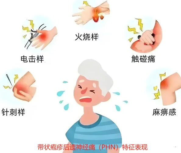 带状疱疹结痂后疼痛不止？关于后遗神经痛的深度解析与科学应对