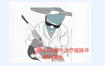 睑黄瘤：一种不能留的皮肤病
