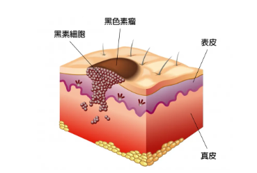 门诊皮肤镜免费检查，让皮肤问题无处藏匿