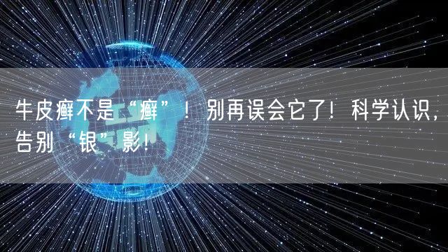 牛皮癣不是“癣”！别再误会它了！科学认识，告别“银”影！